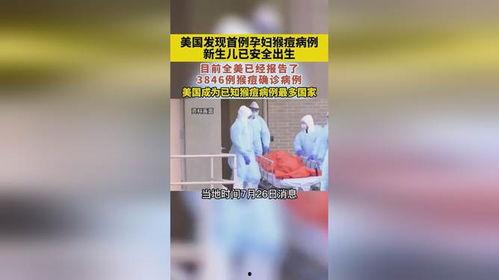 美国猴痘爆料新闻报道视频,最新爆料新闻报道视频揭秘 第1张 美国猴痘爆料新闻报道视频,最新爆料新闻报道视频揭秘 第1张